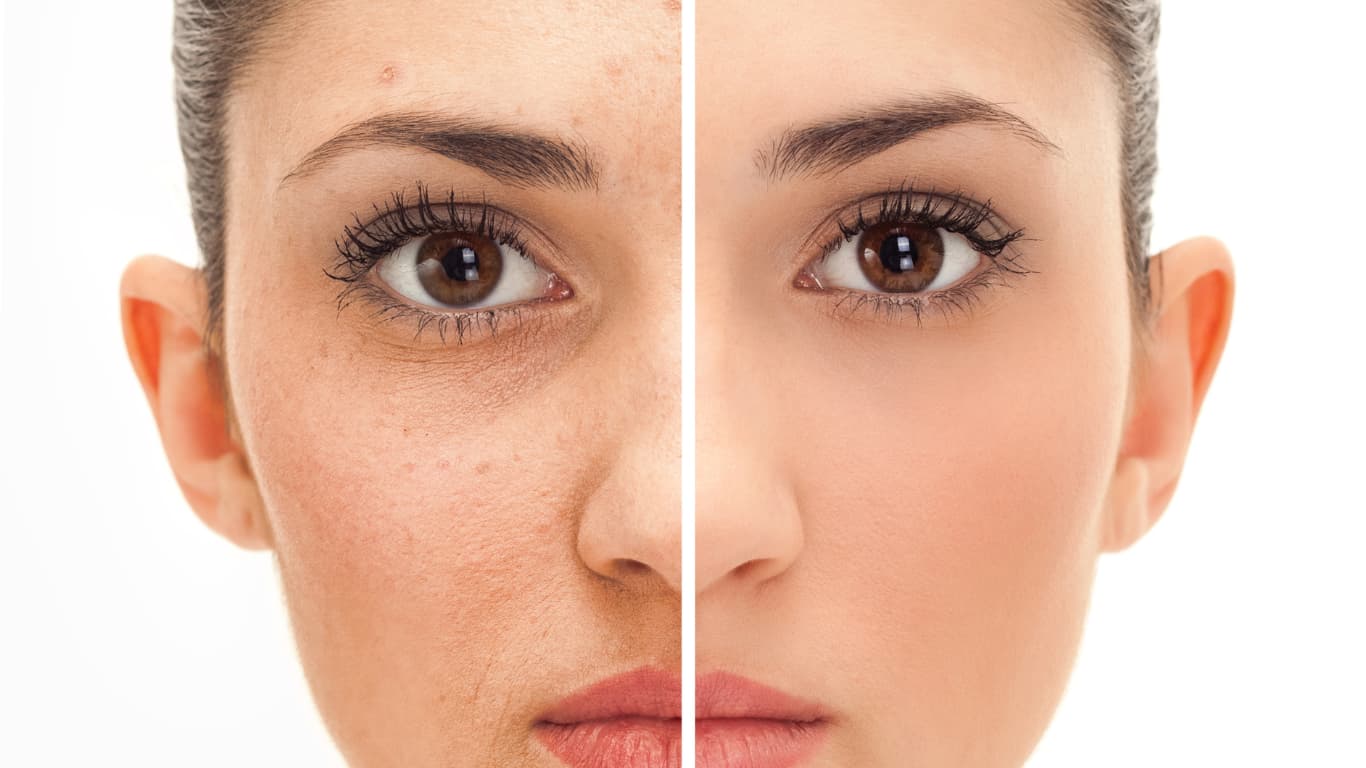 Spring Glowing Skin Tips Unlock Your Radiant Transformation in Just 7 Days!