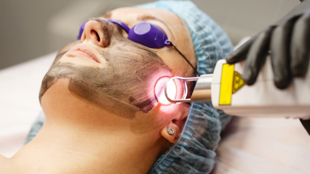 Say Goodbye to Dull Skin – Laser Treatments for Radiant Results