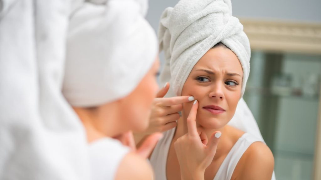 Say Goodbye to Pimples – 7 Easy Tips That Actually Work!